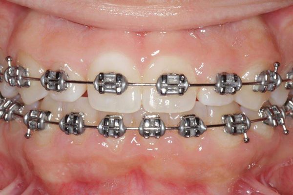Clinicas-Dentales-Grupo-Nefa-ortodoncia-1