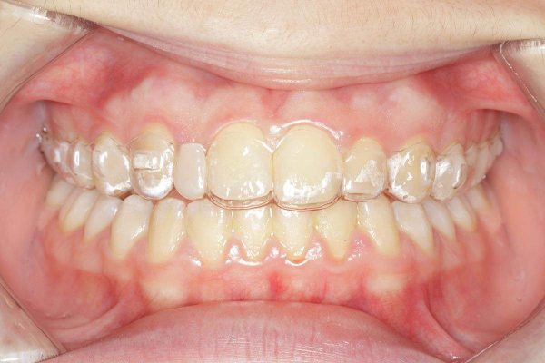 Clinicas-Dentales-Grupo-Nefa-ortodoncia-3